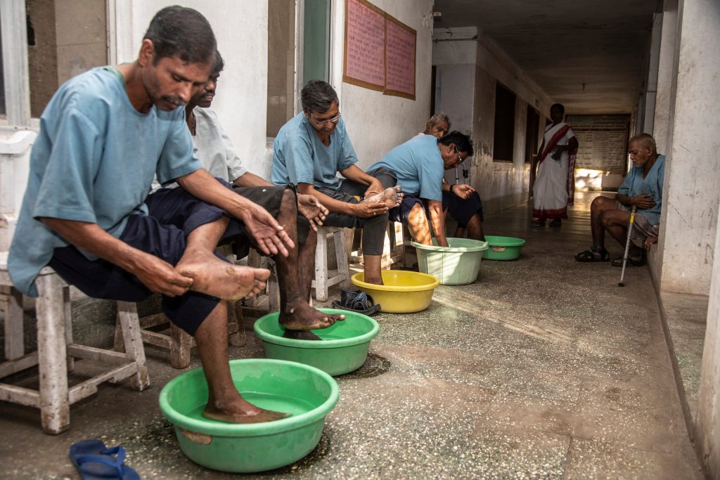 Keeping the foot clean and constantly checking it can prevent damage